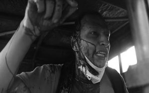 कुलमानको पक्षमा प्रदर्शन गर्ने व्यक्ति घाइते