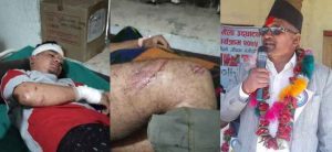 रुकुममा सिडिओकै अगाडि ज्यान मार्ने प्रयास, सांसद जमानी बसेर छुटाए ‘गुण्डा’ रुकुममा सिडिओकै अगाडि ज्यान मार्ने प्रयास, सांसद जमानी बसेर छुटाए ‘गुण्डा’